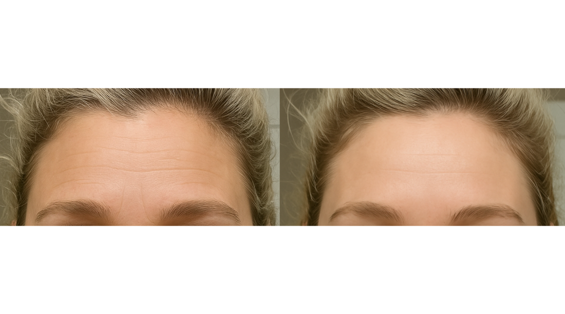 Face Taping 101: Benefits, How It Works & Expert Tips