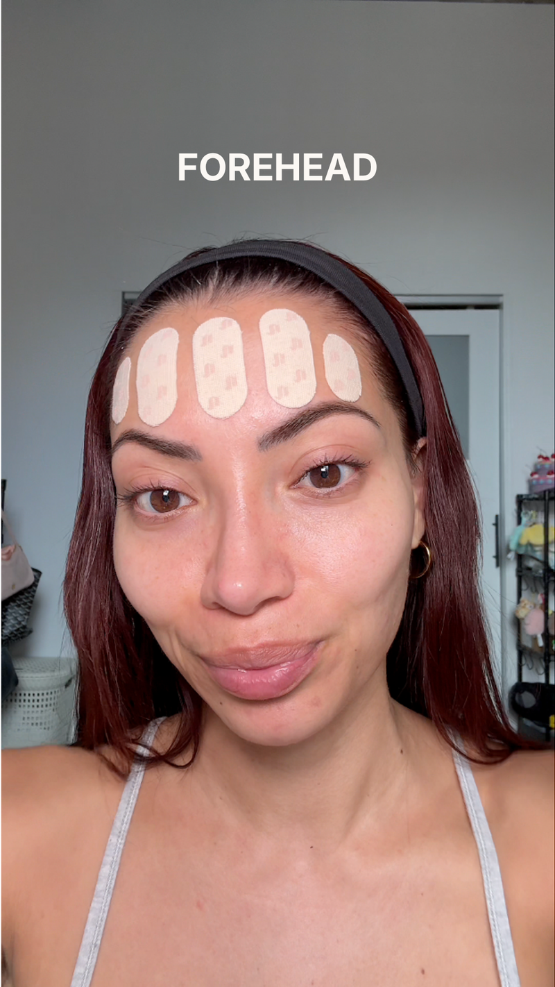 forehead